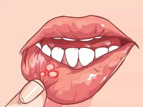 这8种人千万别吃辣,等于慢性自杀