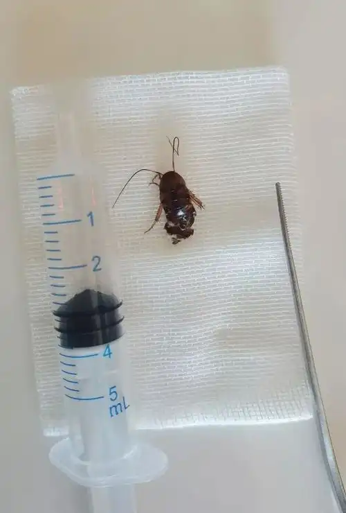 头皮发麻女子睡梦中耳朵疼痛,没想到钻进一只活蟑螂