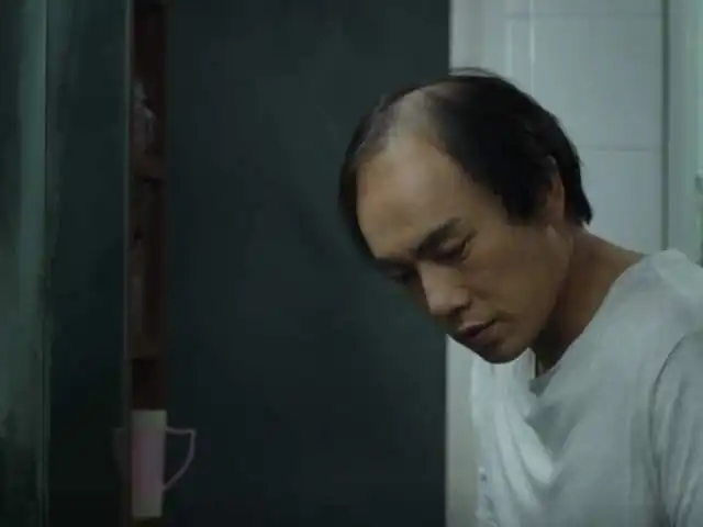年纪轻轻就秃了,我还有机会吗