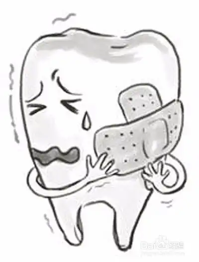 牙髓炎怎么处理