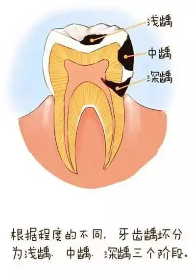 一段很有爱的口腔科普漫画
