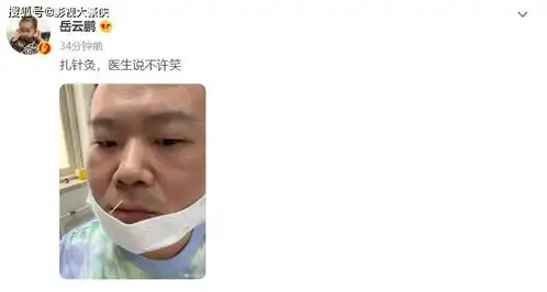 小岳岳针灸,被医生叮嘱不准笑,一脸冷漠不敢动,网友已笑疯