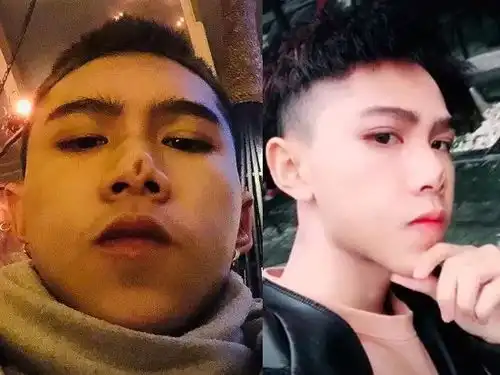 他是抖音130w粉的彭于晏,隆鼻失败变猪鼻子却感到了所有人...