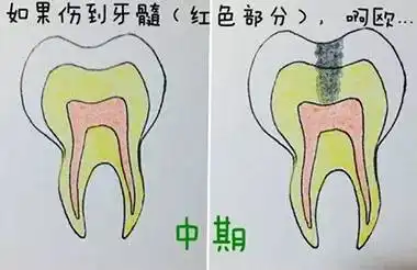 形象生动有趣的比喻,让患者也秒懂牙科